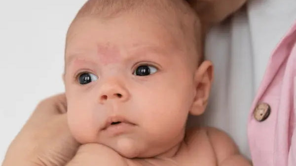 Pipi Bayi Merah-Merah? Belum Tentu Karena Alergi! Simak Penjelasannya