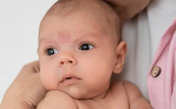 Pipi Bayi Merah-Merah? Belum Tentu Karena Alergi! Simak Penjelasannya