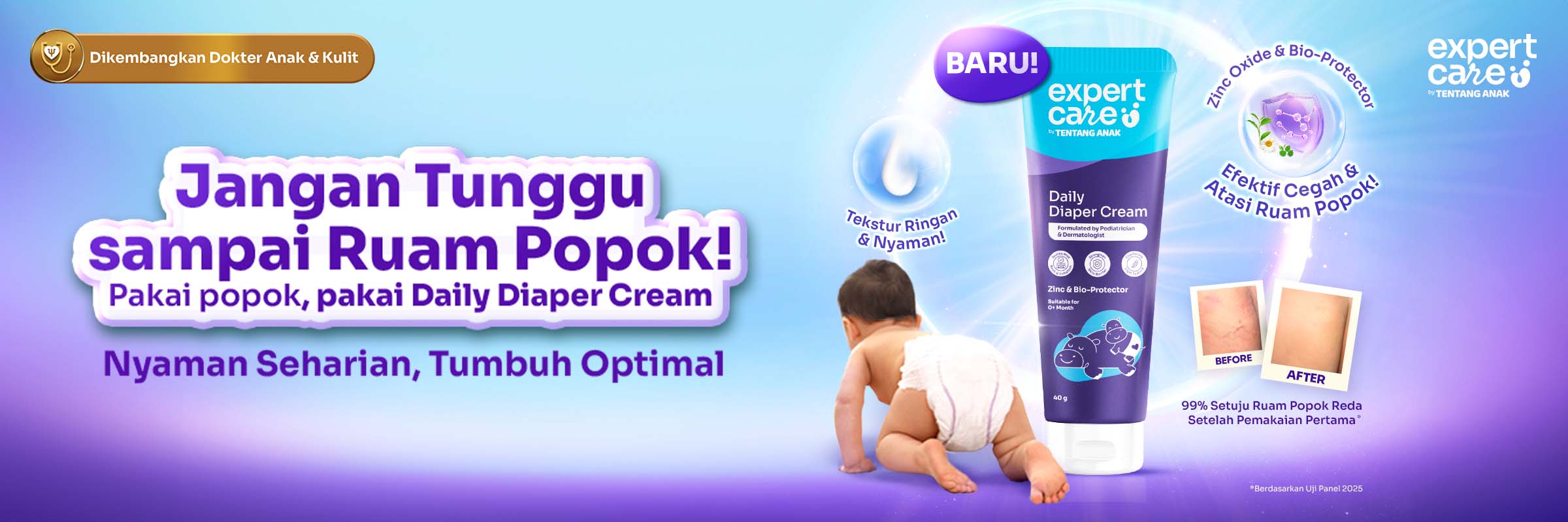 Diaper Cream