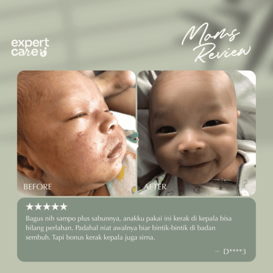 ⁠⁠Expert Care Sabun Anak Hair & Body 250 ml - Sabun Baby 2 in 1 dengan Colloidal Oatmeal - Kulit Lembap & Rambut Tebal