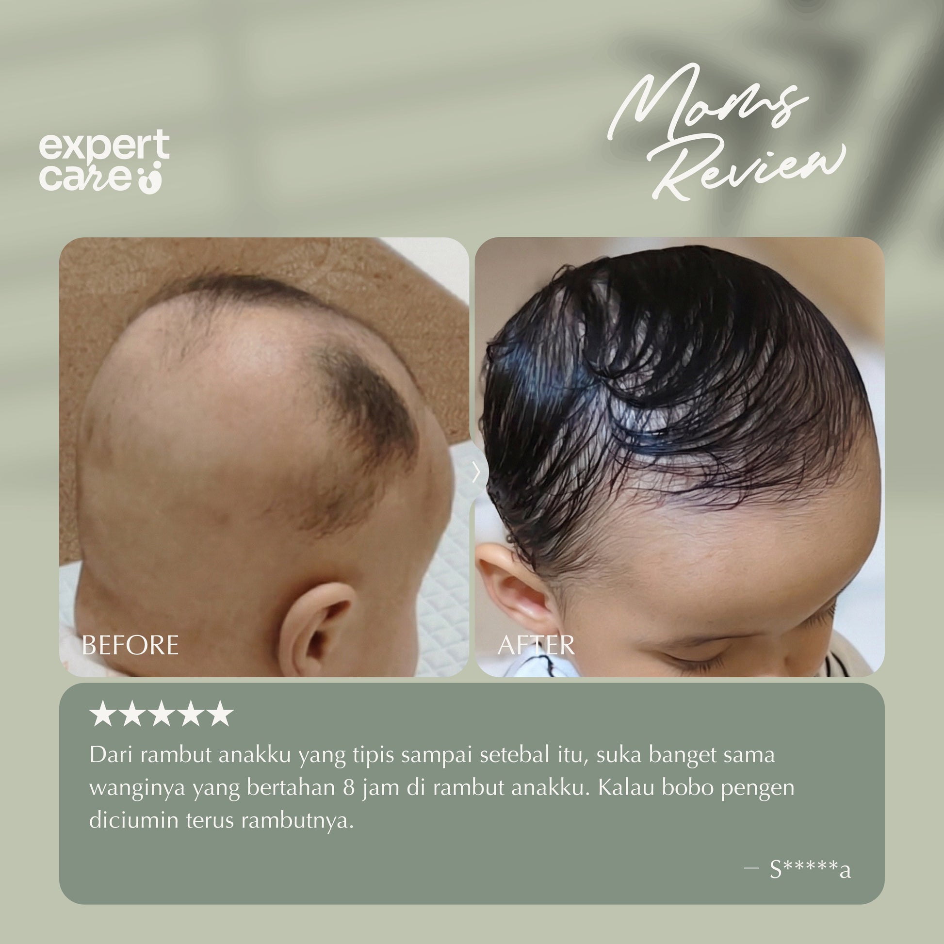 Expert Care Hair Lotion Bayi & Anak 100 ml – Hair Lotion dengan NutriBiotic - Rambut Tebal & Wangi Seharian