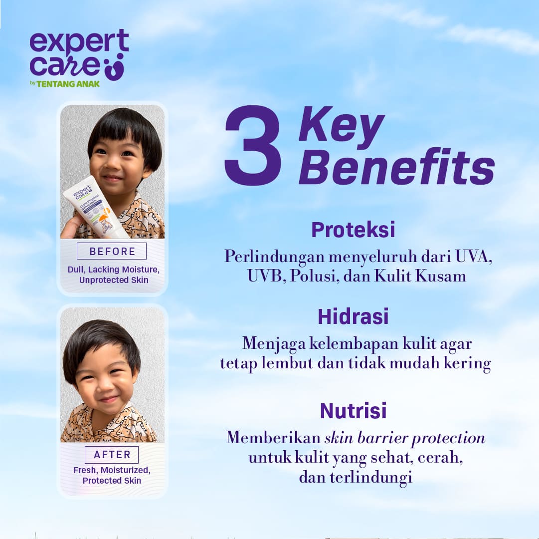 Paket Bundling - Expert Care Physical Sunscreen SPF 50+ PA ++++ 30 gr