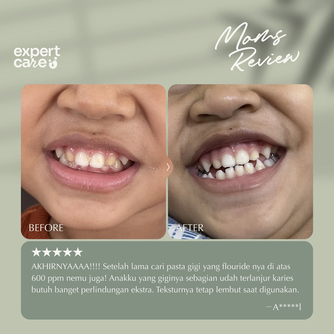 Nutrishine Toothpaste 36gr Pasta Gigi dengan Fluoride 1.000ppm dan Kalsium Fosfat